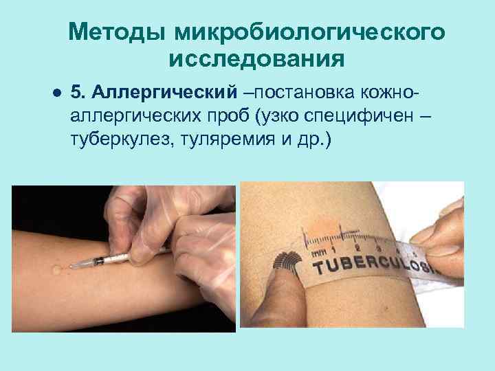 Методы микробиологического исследования l 5. Аллергический –постановка кожноаллергических проб (узко специфичен – туберкулез, туляремия