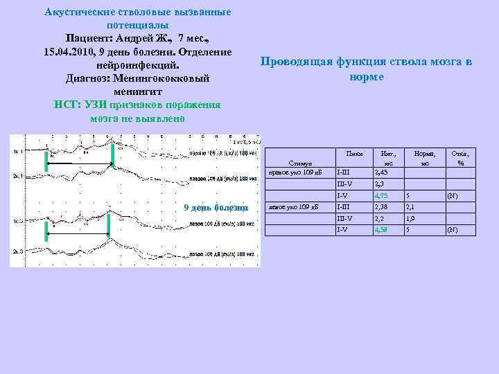 Акустические стволовые вызванные потенциалы Пациент: Андрей Ж. , 7 мес. , 15. 04. 2010,