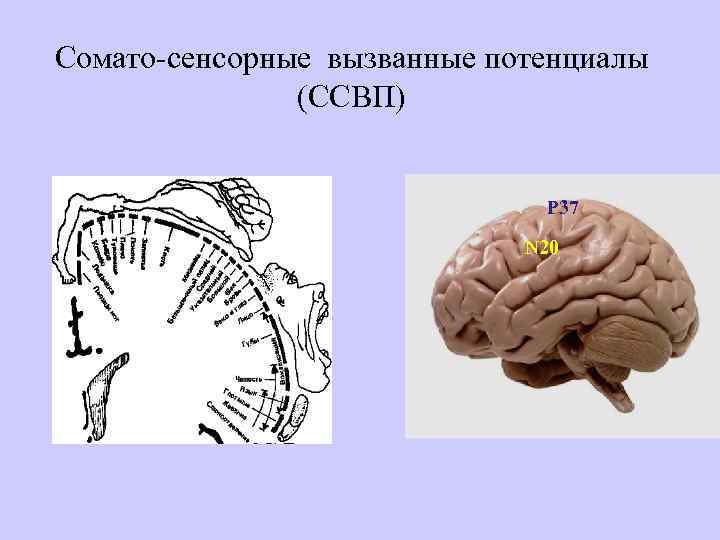 Сомато-сенсорные вызванные потенциалы (ССВП) P 37 N 20 