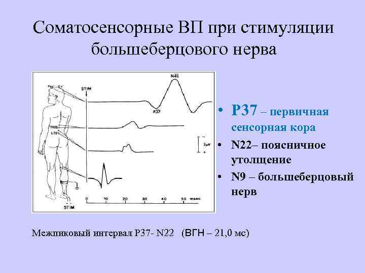 Соматосенсорные ВП при стимуляции большеберцового нерва • P 37 – первичная сенсорная кора •