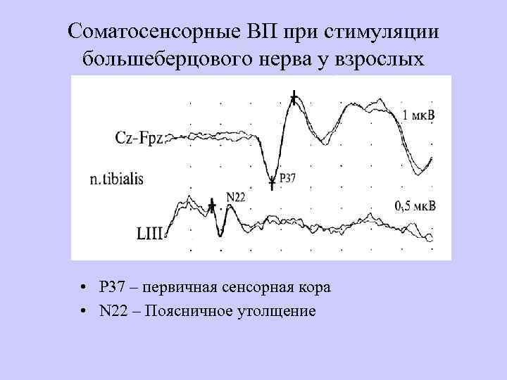 Соматосенсорные ВП при стимуляции большеберцового нерва у взрослых • P 37 – первичная сенсорная