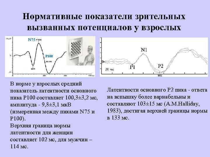 Нормативные показатели зрительных вызванных потенциалов у взрослых N 75 P 100 В норме у