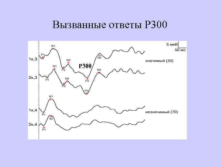 Вызванные ответы Р 300 