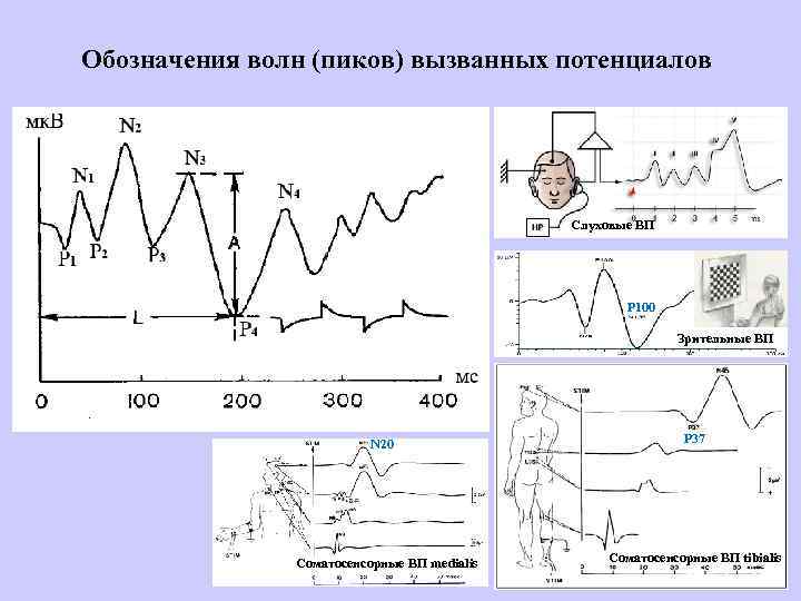 Обозначения волн (пиков) вызванных потенциалов Слуховые ВП P 100 Зрительные ВП N 20 Соматосенсорные