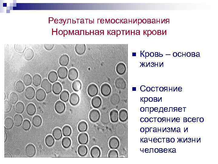 Результаты гемосканирования Нормальная картина крови n Кровь – основа жизни n Состояние крови определяет