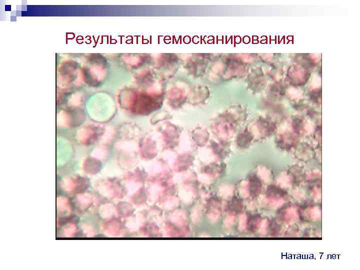 Результаты гемосканирования Наташа, 7 лет 