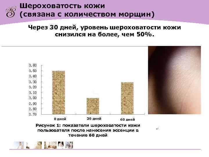 Шероховатость кожи (связана с количеством морщин) Через 30 дней, уровень шероховатости кожи снизился на