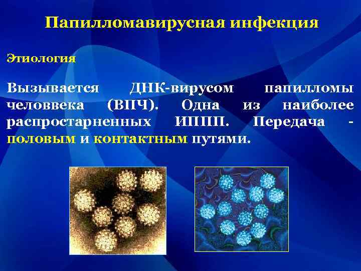 Папилломавирусная инфекция Этиология Вызывается ДНК-вирусом папилломы человвека (ВПЧ). Одна из наиболее распростарненных ИППП. Передача
