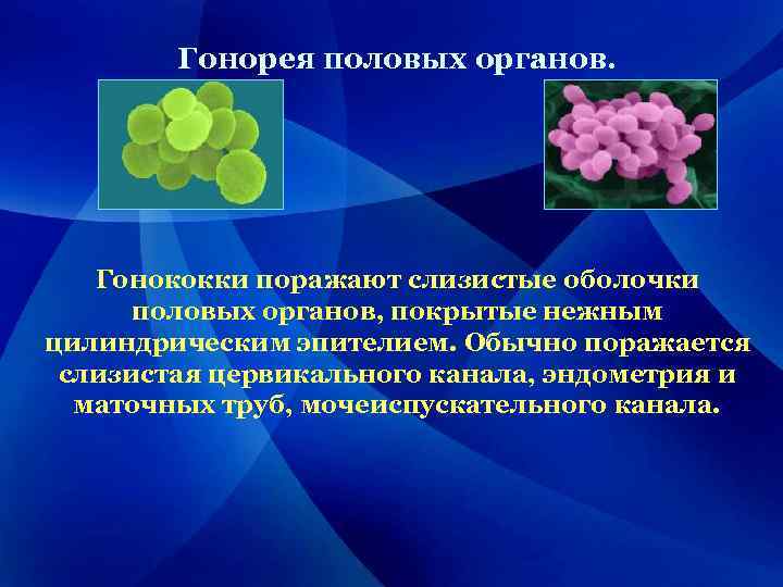 Гонорея половых органов. Гонококки поражают слизистые оболочки половых органов, покрытые нежным цилиндрическим эпителием. Обычно