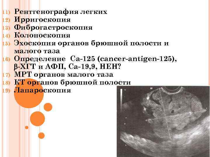 11) 12) 13) 14) 15) 16) 17) 18) 19) Рентгенография легких Ирригоскопия Фиброгастроскопия Колоноскопия