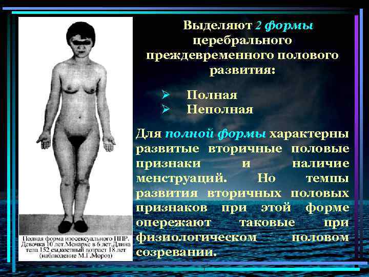 Выделяют 2 формы церебрального преждевременного полового развития: Ø Ø Полная Неполная Для полной формы