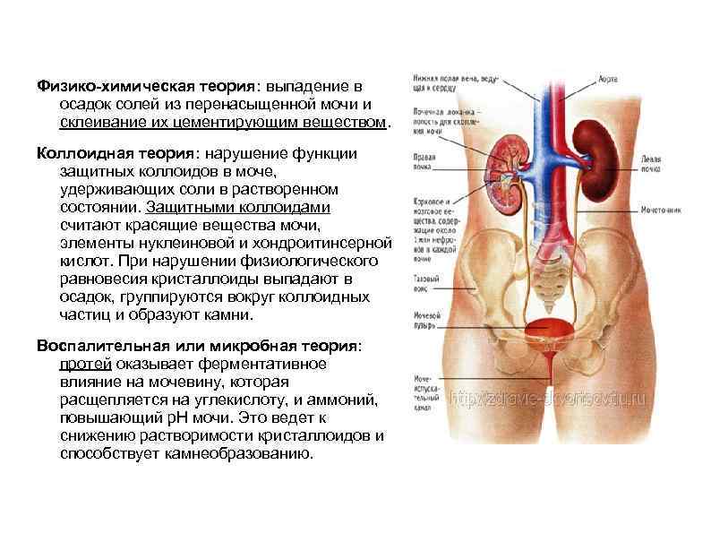 Физико-химическая теория: выпадение в осадок солей из перенасыщенной мочи и склеивание их цементирующим веществом.