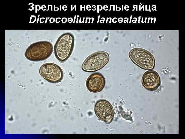 Зрелые и незрелые яйца Dicrocoelium lancealatum 