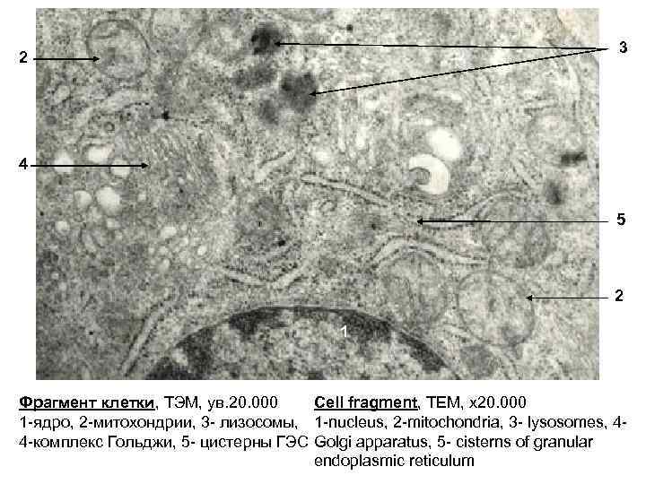 Фрагмент клетки. Фрагмент клетки Электронограмма. Фрагмент клетки комплекс Гольджи Электронограмма. Клетка трансмиссионная электронная микроскопия. Фрагмент клетки препарат.