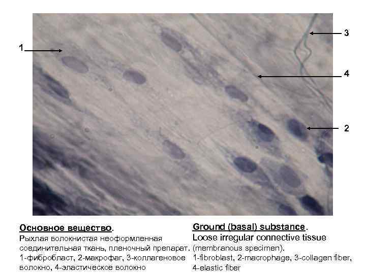 Ткань препарат. Рыхлая волокнистая неоформленная соединительная ткань препарат. Рыхлая волокнистая неоформленная соединительная ткань гистология. Рыхлая соединительная ткань гистология препарат. Рыхлая неоформленная соединительная ткань препарат гистология.