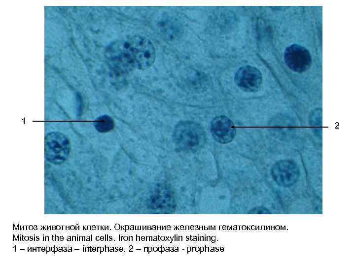 Деление клеток спорогенной ткани. Препарат митоз животной клетки краевая зона печени аксолотля. Клетки печени аксолотля гистология. Кариокинез гистология препарат. Центросома гистология.