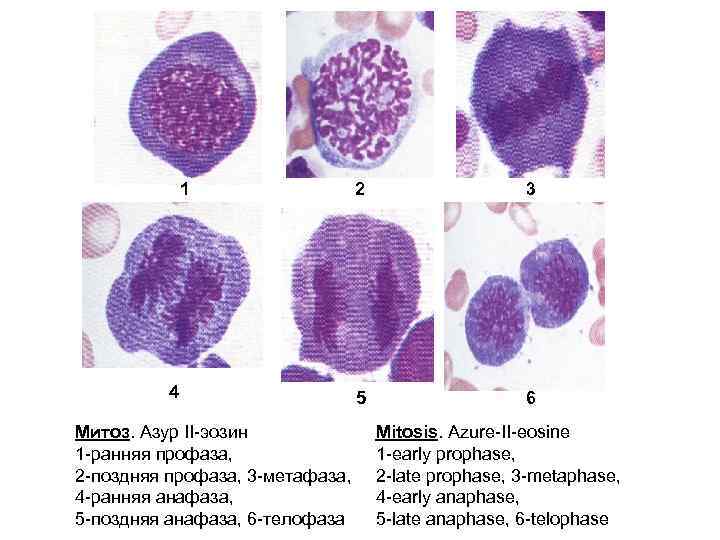Фрагмент клетки. Азур 2 эозин. Митоз клеток крови. Ранняя и поздняя профаза митоза. Ранняя профаза гистология.