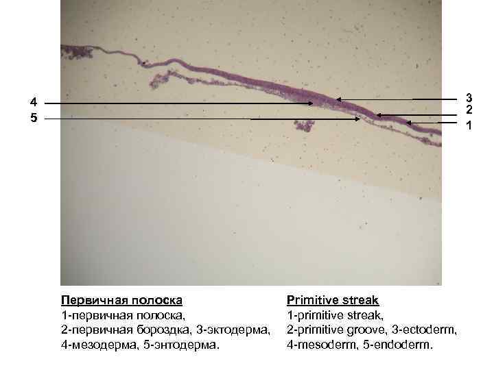 3 2 1 4 5 Первичная полоска 1 -первичная полоска, 2 -первичная бороздка, 3