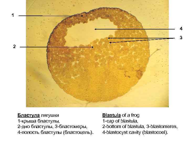 Гаструла лягушки рисунок