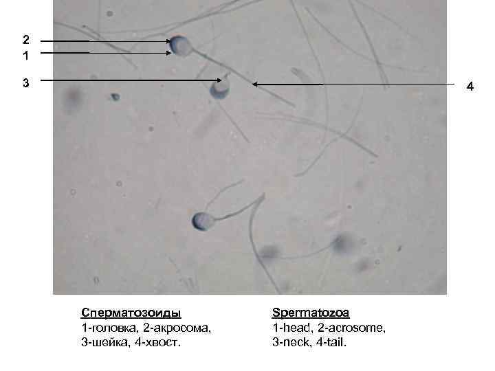 2 1 3 4 Сперматозоиды 1 -головка, 2 -акросома, 3 -шейка, 4 -хвост. Spermatozoa