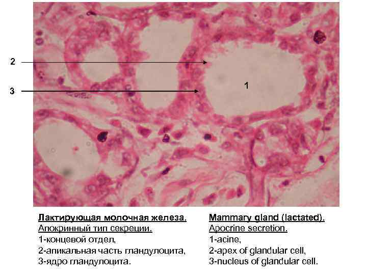 2 1 3 Лактирующая молочная железа. Апокринный тип секреции. 1 -концевой отдел, 2 -апикальная