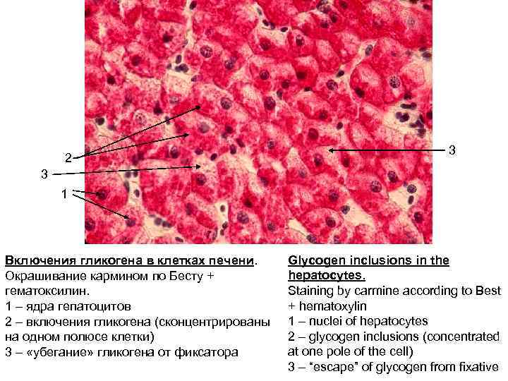 Железистые клетки печени. Включения гликогена в печени аксолотля. Включения гликогена в клетках печени окраска кармином по Бесту. Включения гликогена окраска кармином. Включения гликогена в клетках печени.
