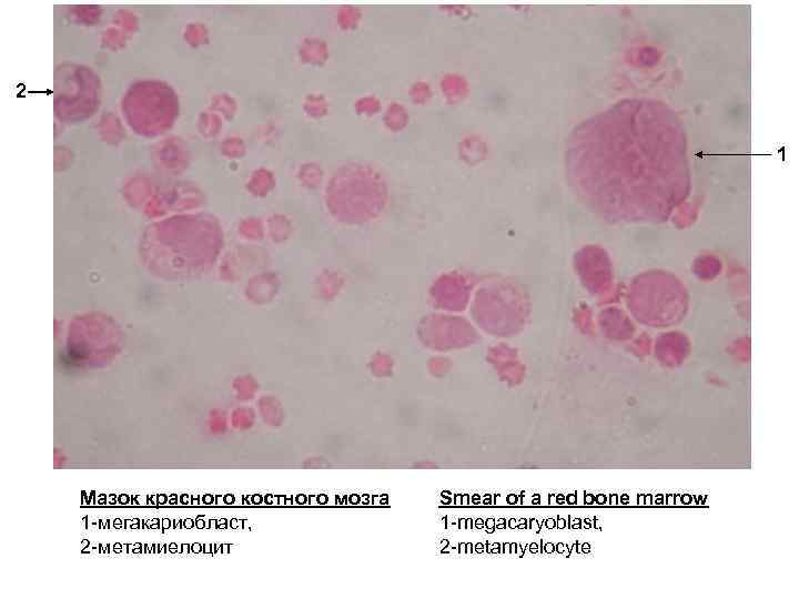 Мазок красного костного мозга рисунок