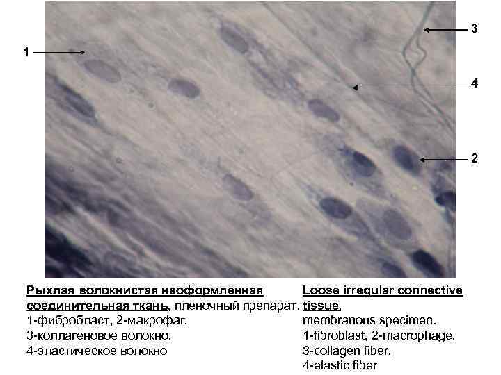 Рыхлая волокнистая неоформленная соединительная ткань рисунок