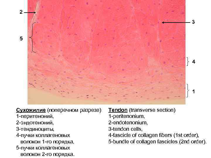 Сухожилие ткань. Плотная оформленная соединительная ткань в поперечном разрезе. Плотная оформленная соединительная ткань поперечный срез. Сухожилие гистология препарат. Плотная волокнистая соединительная ткань поперечный срез.