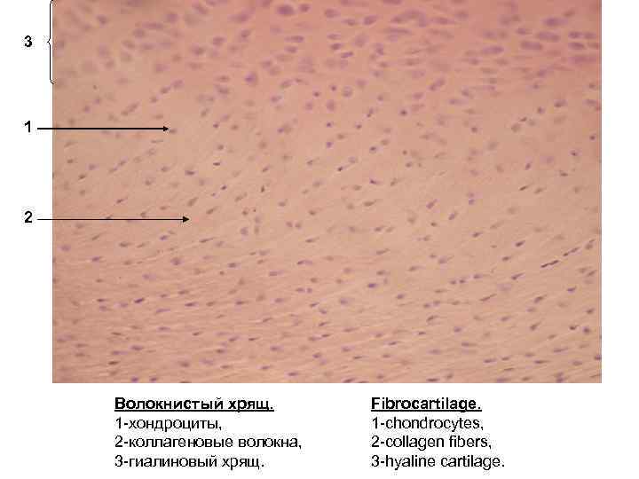 Волокнистый хрящ гистология