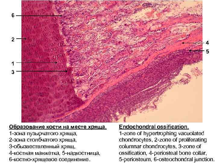 Развитие кости на месте хряща гистология рисунок