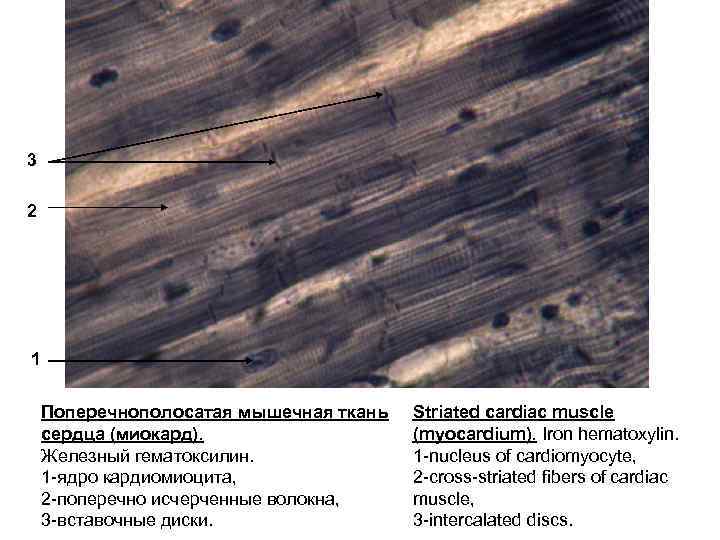 3 2 1 Поперечнополосатая мышечная ткань сердца (миокард). Железный гематоксилин. 1 -ядро кардиомиоцита, 2