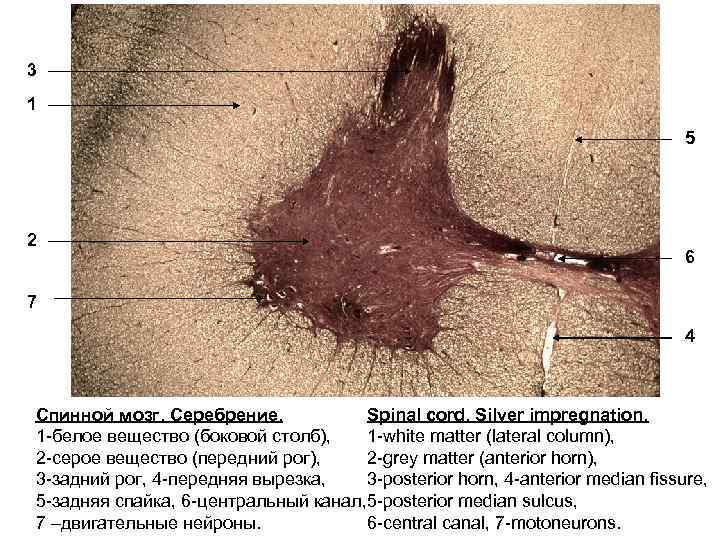 3 1 5 2 6 7 4 Спинной мозг. Серебрение. Spinal cord. Silver impregnation.