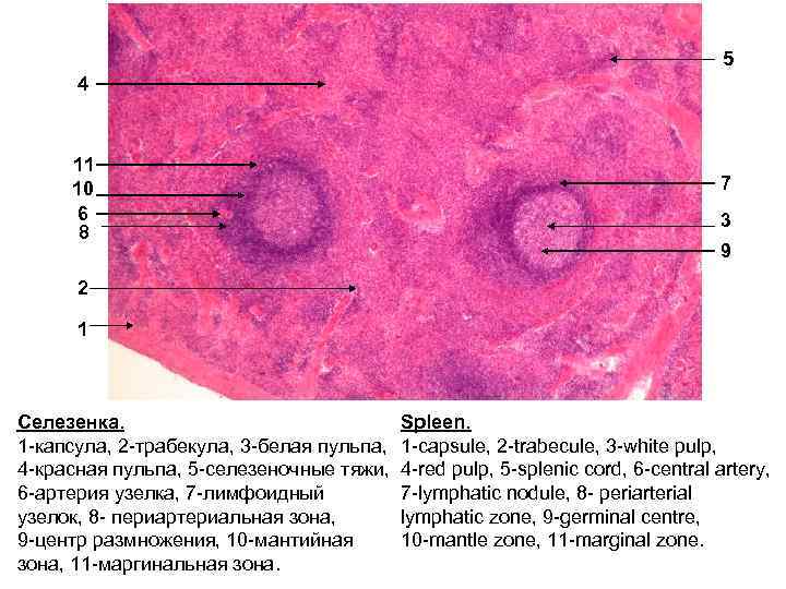 5 4 11 10 6 8 7 3 9 2 1 Селезенка. 1 -капсула,