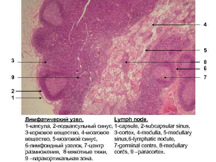 Микропрепарат лимфатический узел. Корковое вещество лимфатического узла. Подкапсульный синус лимфатического узла. Электронные фотографии гистология. Паракортикальные клетки.