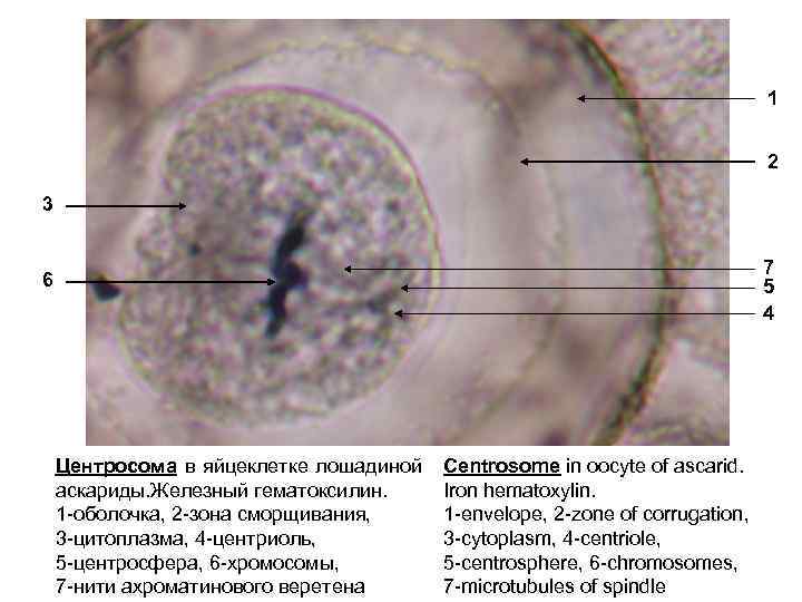 В яйцеклетке человека содержится 23 хромосомы. Центросома в яйцеклетке лошадиной аскариды. Митоз яйцеклетки лошадиной аскариды. Клеточный центр в яйце аскариды микроскоп. Центросома и ахроматиновое Веретено в яйцеклетке лошадиной аскариды..