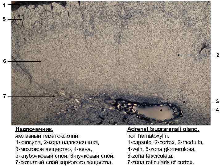 1 5 2 6 7 3 4 Надпочечник, железный гематоксилин. 1 -капсула, 2 -кора