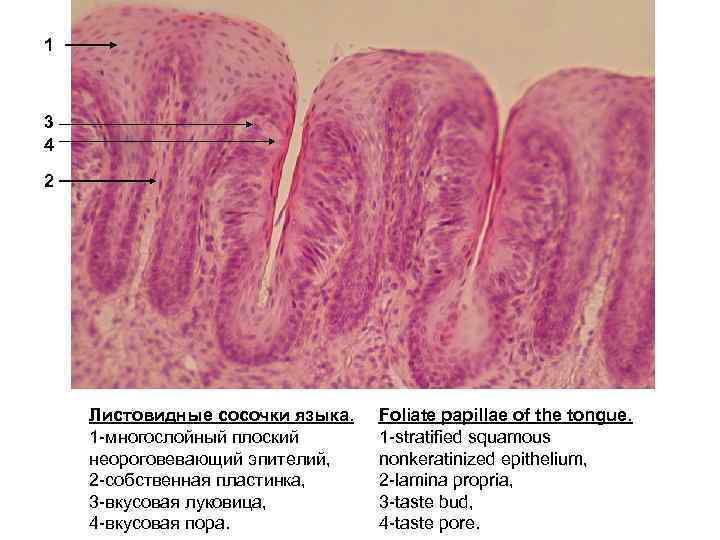 Язык ткани. Листовидные сосочки гистология препарат. Вкусовые почки (листовидные сосочки языка) препарат. Листовидные сосочки языка вкусовые луковицы препарат. Листовидный сосочек языка гистология.