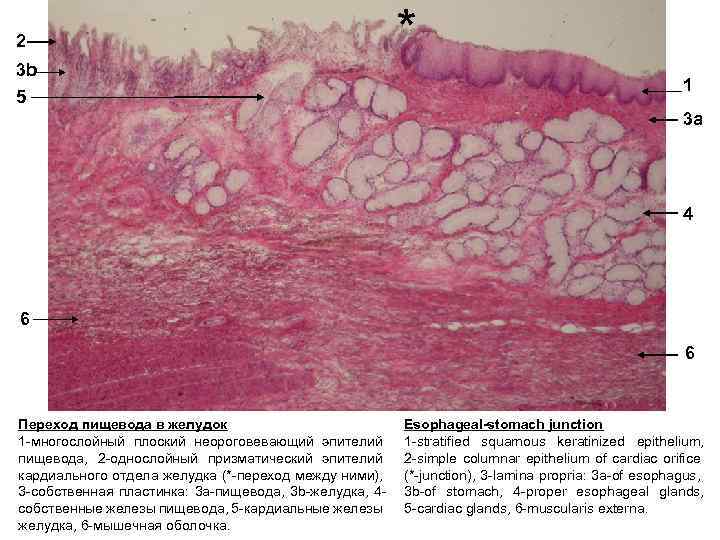Переход пищевода в желудок гистология рисунок