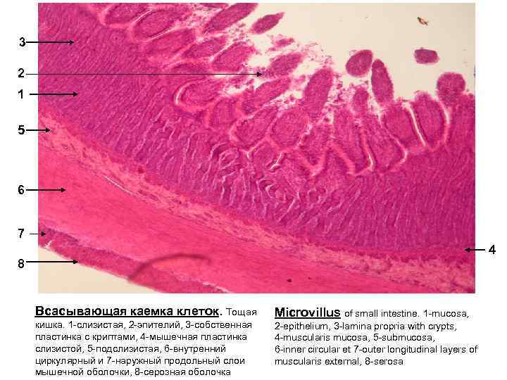 Слизистая оболочка матки. Каемчатый эпителий гистология. Однослойный призматический каемчатый эпителий тощей кишки. Эпителий тощей кишки гистология. Тощая кишка гистология препарат.