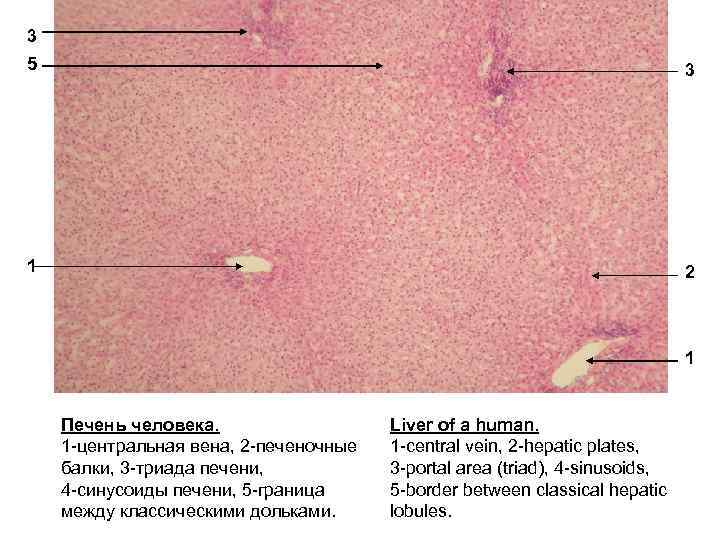 3 5 3 1 2 1 Печень человека. 1 -центральная вена, 2 -печеночные балки,