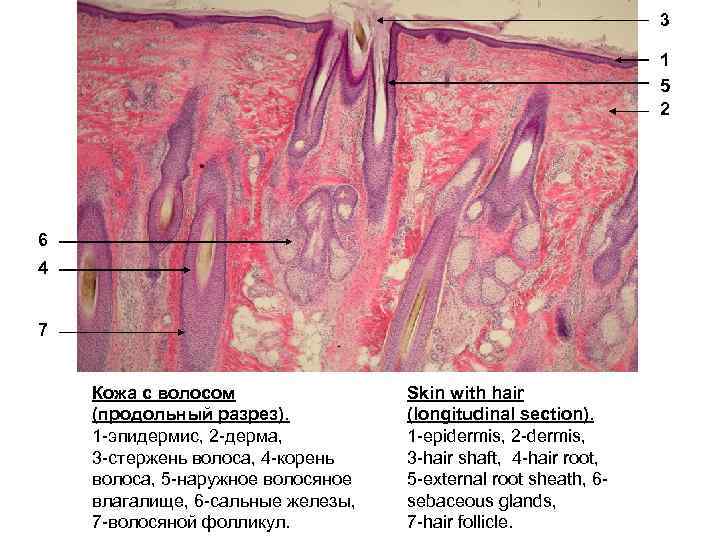 3 1 5 2 6 4 7 Кожа с волосом (продольный разрез). 1 -эпидермис,