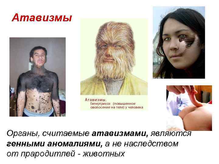 Атавизмы Органы, считаемые атавизмами, являются генными аномалиями, а не наследством от прародитлей - животных