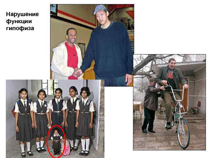 Нарушение функции гипофиза 