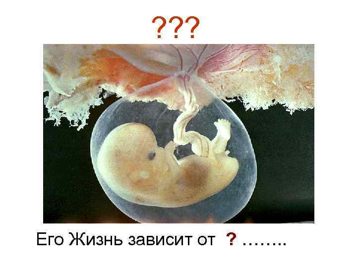 ? ? ? Его Жизнь зависит от ? ……. . 