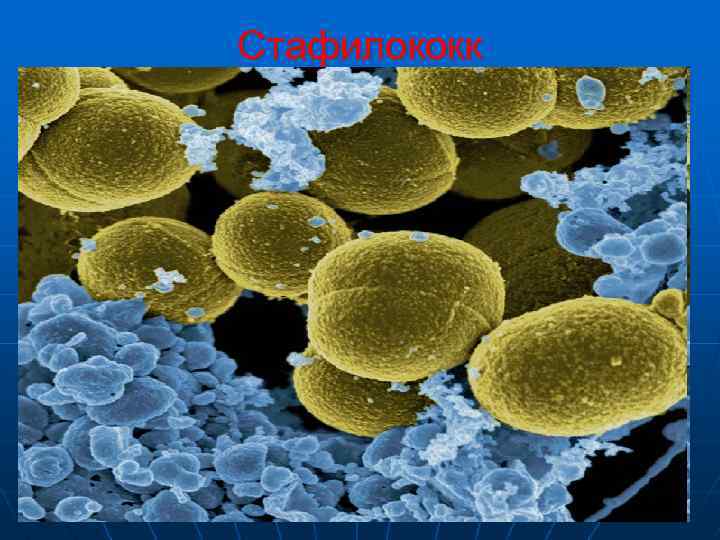 Стафилококк 