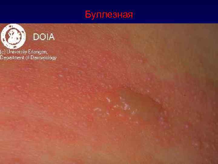 Буллезная 