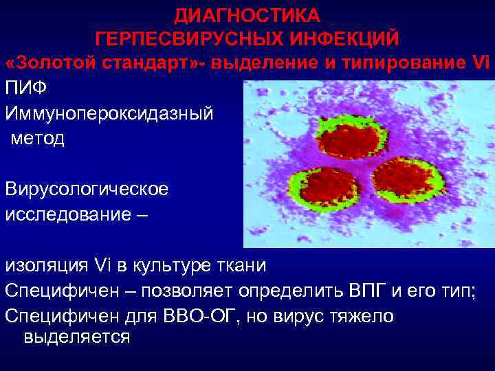 Герпесвирусная инфекция