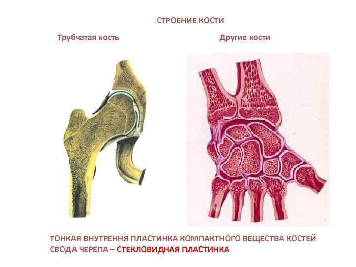 Трабекулярный рисунок кости