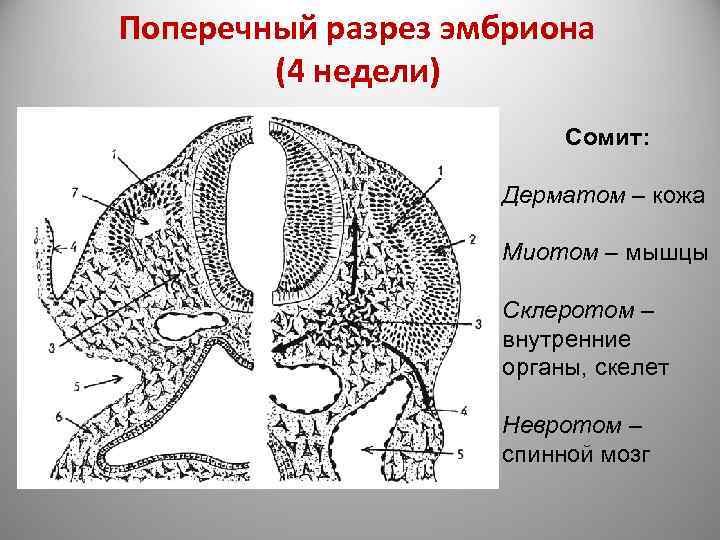 Поперечный разрез эмбриона (4 недели) Сомит: Дерматом – кожа Миотом – мышцы Склеротом –